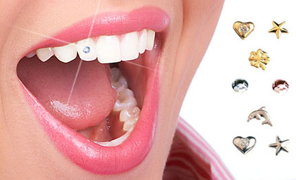 tooth-jewellery